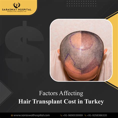 Expense of blue magic hair transplant in turkey